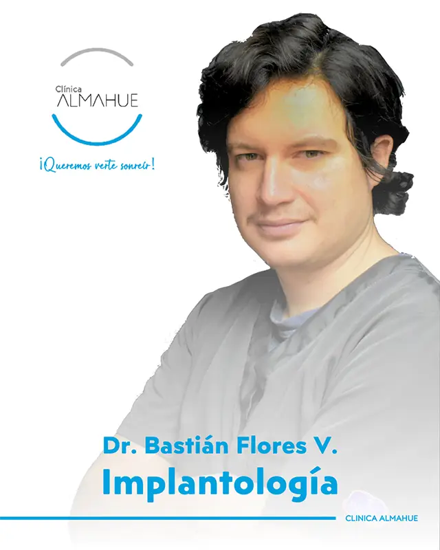 Especialista en implantes dentales